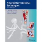 Neurointerventional Techniques
Tricks of the Trade
