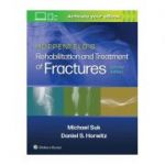 Hoppenfeld's Treatment and Rehabilitation of Fractures