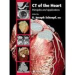 CT of the Heart, Principles and Applications