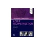 Complications in Orthopaedics: Adult Reconstruction