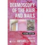 Dermoscopy of the Hair and Nails