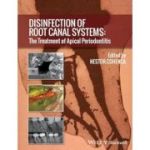 Disinfection of Root Canal Systems: The Treatment of Apical Periodontitis