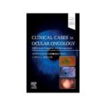 Clinical Cases in Ocular Oncology, Differential Diagnosis and Management