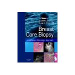 Breast Core Biopsy, A Pathologic-Radiologic Approach