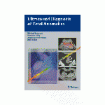 Ultrasound Diagnosis of Fetal Anomalies