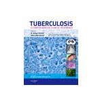 Tuberculosis, A Comprehensive Clinical Reference