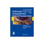 Endoscopic Extraperitoneal Radical Prostatectomy, Laparoscopic and Robot-Assisted Surgery