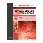 Dermatological Signs of Internal Disease, Expert Consult - Online and Print