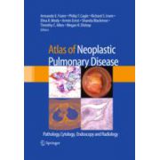 Atlas of Neoplastic Pulmonary Disease Pathology, Cytology, Endoscopy and Radiology