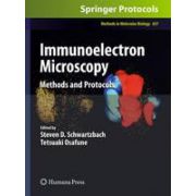 Immunoelectron Microscopy: Methods and Protocols