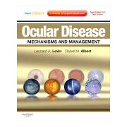 Ocular Disease: Mechanisms and Management Expert Consult - Online and Print