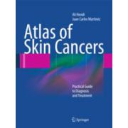 Atlas of Skin Cancers Practical Guide to Diagnosis and Treatment