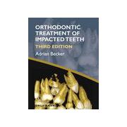 Orthodontic Treatment of Impacted Teeth