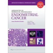 Advances in Surgical Pathology: Endometrial Carcinoma