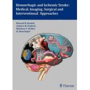 Hemorrhagic and Ischemic Stroke: Medical, Imaging, Surgical and Interventional Approaches