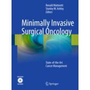 Minimally Invasive Surgical Oncology State-of- the-Art Cancer Management with DVD