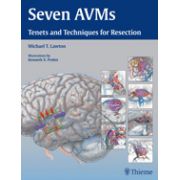 Seven AVMs Tenets and Techniques for Resection