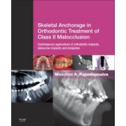Skeletal Anchorage in Orthodontic Treatment of Class II Malocclusion, Contemporary applications of orthodontic implants, miniscrew implantsand mini plates