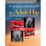 The Adult Hip: 3e HIP ARTHROPLASTY SURGERY