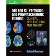 MR & CT Perfusion Imaging: Clinical Applications and Theoretical Principles