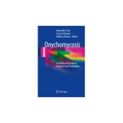 Onychomycosis An Illustrated Guide to Diagnosis and Treatment