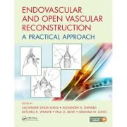Endovascular and Open Vascular Reconstruction: A Practical Approach