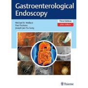 Gastroenterological Endoscopy