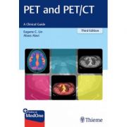PET and PET/CT
A Clinical Guide