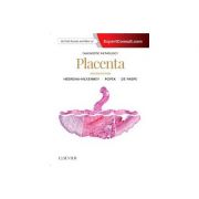 Diagnostic Pathology: Placenta