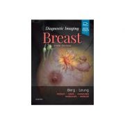 Diagnostic Imaging: Breast