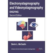 Electronystagmography and Videonystagmography (ENG/VNG)