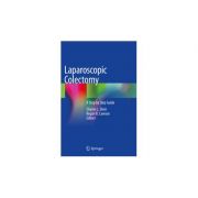 Laparoscopic Colectomy
A Step by Step Guide