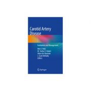 Carotid Artery Disease
Evaluation and Management