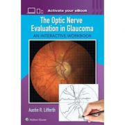 The Optic Nerve Evaluation in Glaucoma
An Interactive Workbook