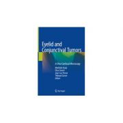 Eyelid and Conjunctival Tumors
In Vivo Confocal Microscopy