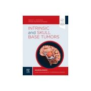 Intrinsic and Skull Base Tumors
Neurosurgery: Case Management Comparison Series