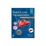 Pediatric Liver Transplantation
A Clinical Guide