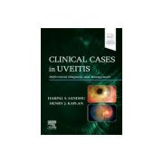 Clinical Cases in Uveitis, 
Differential Diagnosis and Management