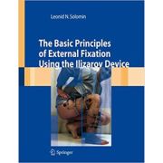 The Basic Principles of External Skeletal Fixation Using the Ilizarov Device