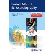 Pocket Atlas of Echocardiography
