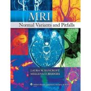 MRI Normal Variants and Pitfalls