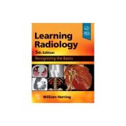 Learning Radiology, Recognizing the Basics