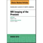 MR Imaging of the Prostate, An Issue of Radiologic Clinics of North America