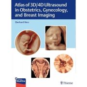 Atlas of 3D/4D Ultrasound in Obstetrics, Gynecology, and Breast Imaging