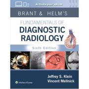 Brant & Helm's Fundamentals of Diagnostic Radiology: Print + eBook with Multimedia