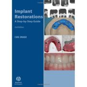 Implant Restoration Solutions: A Step-by-Step Guide