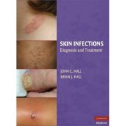 Skin Infections: Diagnosis and Treatment