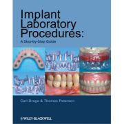 Implant Laboratory Procedures: A Step-by-Step Guide