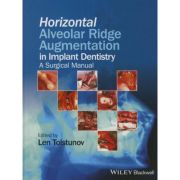 Horizontal Alveolar Ridge Augmentation in Implant Dentistry: A Surgical Manual