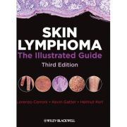 Skin Lymphoma: The Illustrated Guide